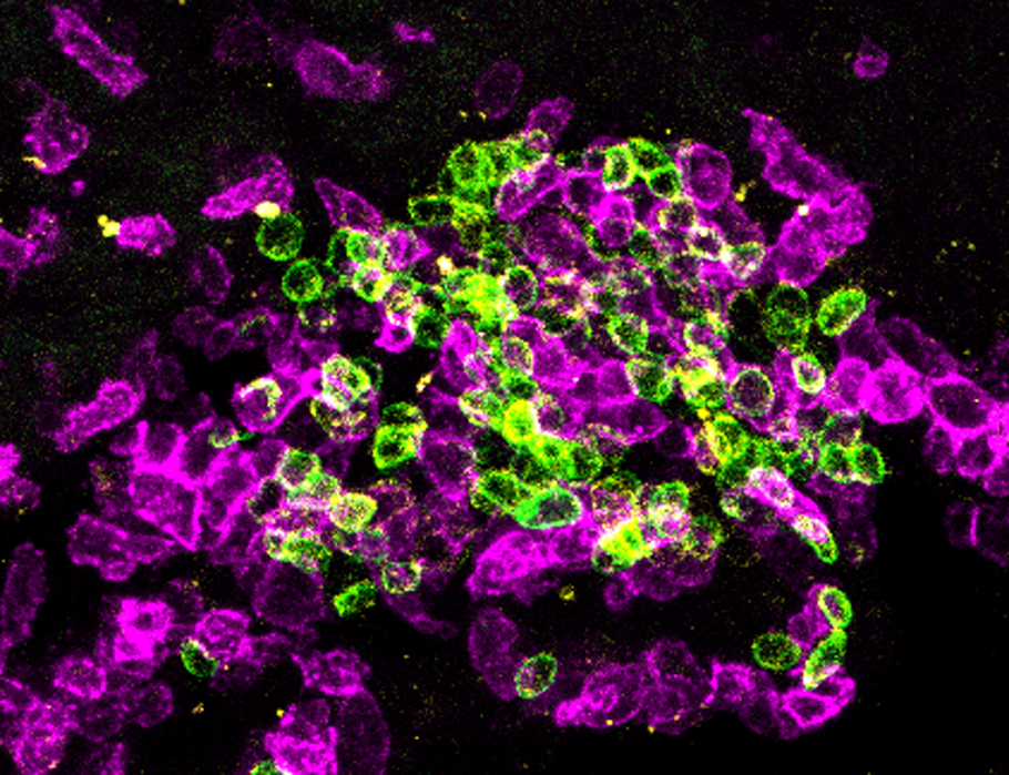Science Immunology (@sciimmunology) on Twitter photo Scientists have identified extensive interactions between T and B cells in the #meninges that promote CNS inflammation in mouse models of #MultipleSclerosis. <a href="/LMU_Muenchen/">Universität München</a>
Read more in Science #Immunology: scim.ag/4jP19Xz Scientists have identified extensive interactions between T and B cells in the #meninges that promote CNS inflammation in mouse models of #MultipleSclerosis. <a href="/LMU_Muenchen/">Universität München</a>
Read more in Science #Immunology: scim.ag/4jP19Xz