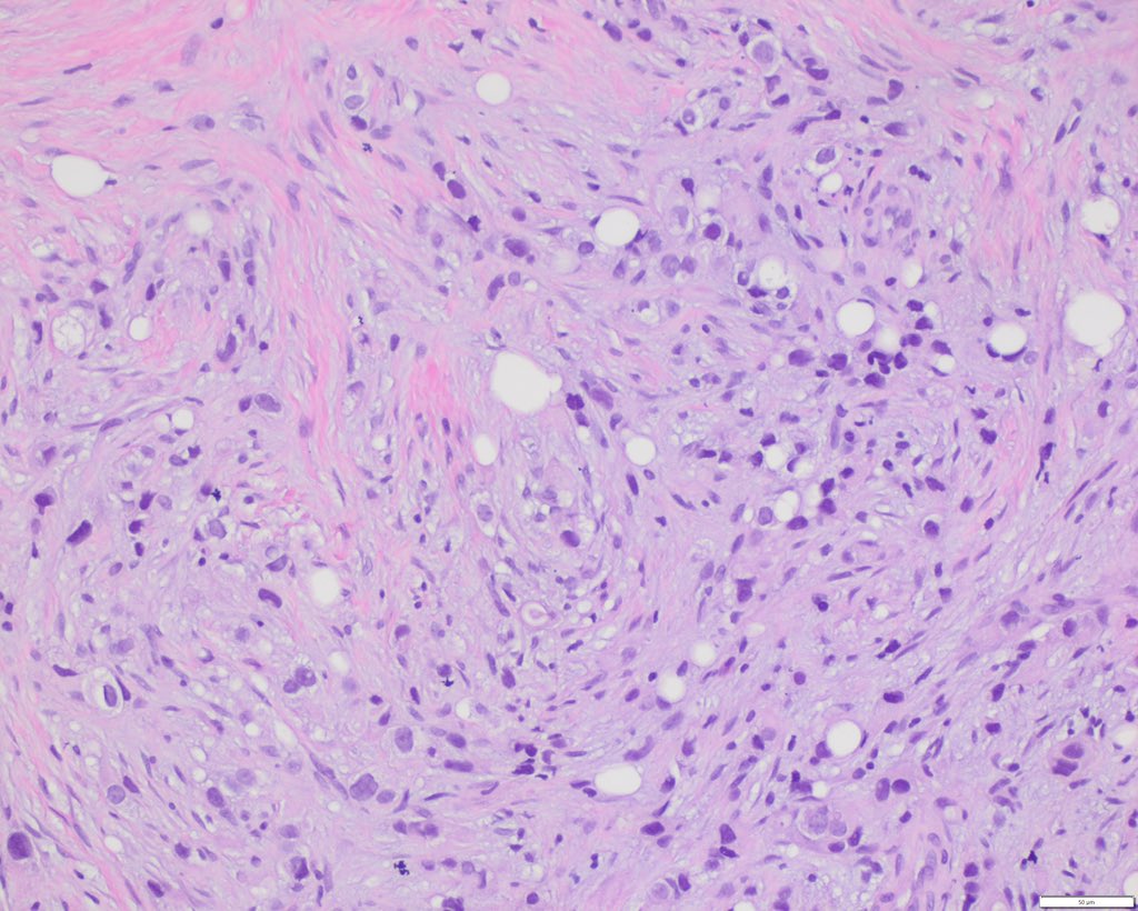 Sanam Loghavi, MD صنم لغوی 🔬🧬 tweet media