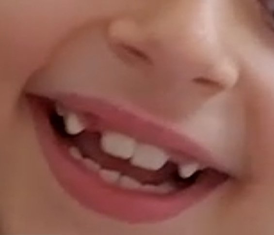 tugbamio's tweet photo. Yegenimin disleri dökülüyor ama öyle simetrik dökülmüs ki özel tasarim gibi of allahim baktikca deliriyorum nasil bu kadar tatlı olabilirsiinn :( https://t.co/h4KG6v417G