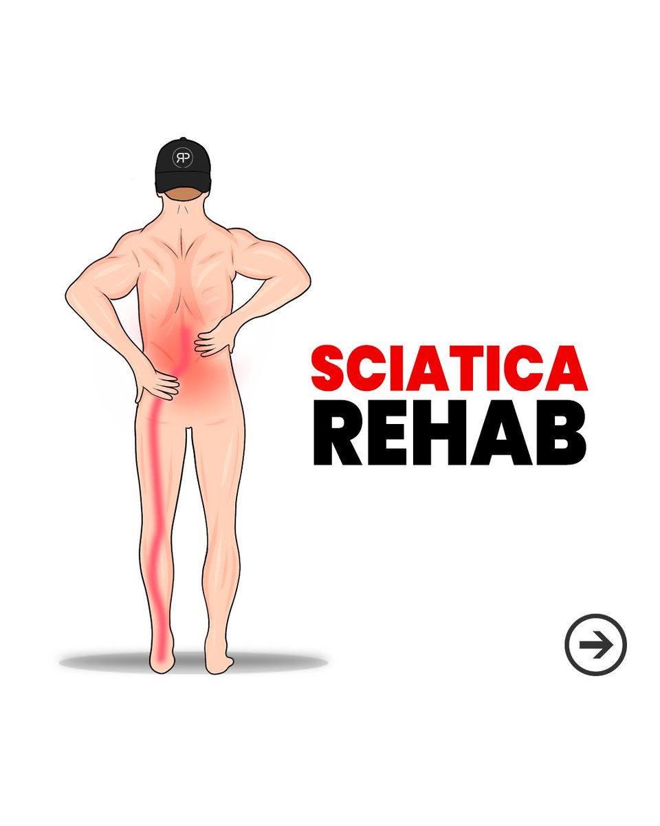 💥 What is Sciatica 

Sciatica is a type of pain that stems from the irritation or inflammation of the sciatic nerve, the longest nerve in the human body 

Here's how to get pain-free in 3 steps: 💯👇