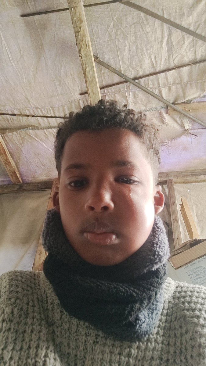 samer_1701's tweet photo. Don't ignore me Saeed's eye is swelling rapidly, causing a puffiness underneath.The pain is unbearable and his smiling face needs treatment. Saeed is waiting for your touch Share with him, donate or pray for him. This little heart deserves a pain free life
https://t.co/xgpvO81clc https://t.co/96TCYIiF9y