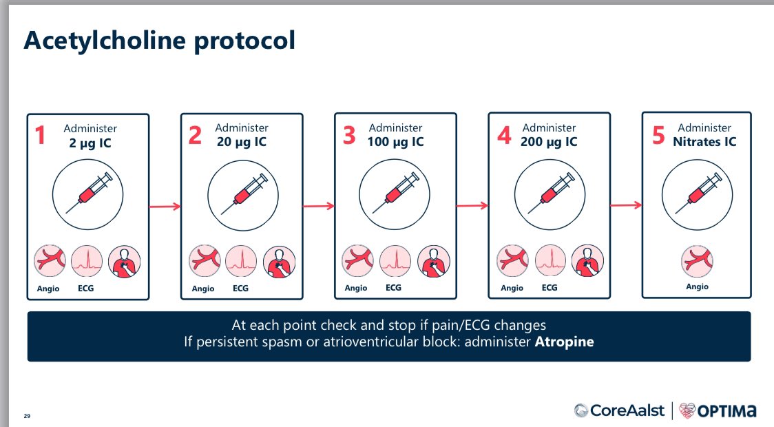 Carlos Collet MD PhD (@colletcarlos) on Twitter photo Acetylcholine testing for coronary spasm in the cath lab:
A protocol that should become standard of care for patients with ANOCA.
<a href="/VijayKunadian/">Professor Vijay Kunadian</a> <a href="/PCRonline/">PCRonline 🫀</a> <a href="/ESC_Journals/">European Society of Cardiology Journals</a> <a href="/JEscaned/">Javier Escaned</a> Acetylcholine testing for coronary spasm in the cath lab:
A protocol that should become standard of care for patients with ANOCA.
<a href="/VijayKunadian/">Professor Vijay Kunadian</a> <a href="/PCRonline/">PCRonline 🫀</a> <a href="/ESC_Journals/">European Society of Cardiology Journals</a> <a href="/JEscaned/">Javier Escaned</a>