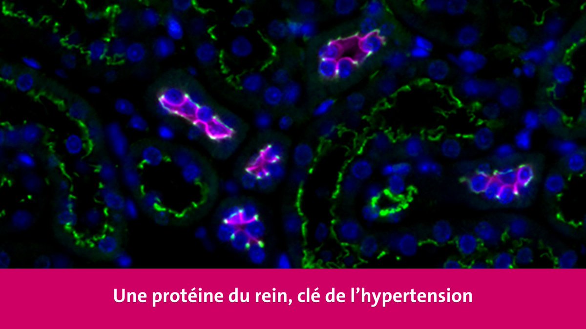 Université de Genève (@unigenews) on Twitter photo L’hypertension artérielle est l’un des principaux facteurs de risque de maladies cardiovasculaires🫀.
Des scientifiques de l’UNIGE se sont penché-es sur le rôle d’une protéine, la paracinguline, dans cette maladie. Leur récente étude🔬met en lumière sa contribution déterminante L’hypertension artérielle est l’un des principaux facteurs de risque de maladies cardiovasculaires🫀.
Des scientifiques de l’UNIGE se sont penché-es sur le rôle d’une protéine, la paracinguline, dans cette maladie. Leur récente étude🔬met en lumière sa contribution déterminante