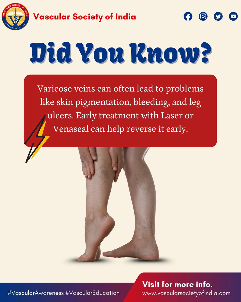 🚨 Varicose veins aren’t just ugly — they can bleed, darken your skin, and cause painful ulcers. Treat early with Laser or Venaseal! 💡
#VaricoseVeins #VeinTreatment #LaserTreatment #Venaseal #HealthyLegs #VeinCare #LegPainRelief #SkinHealth #StopTheUlcers #NonSurgicalTreatment