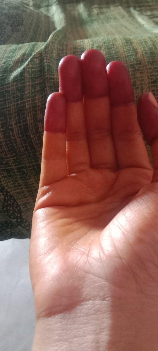 कॉलर ज्यादा होता है तब ज्यादा गहरा आता है 
😂🤣🙆🙊