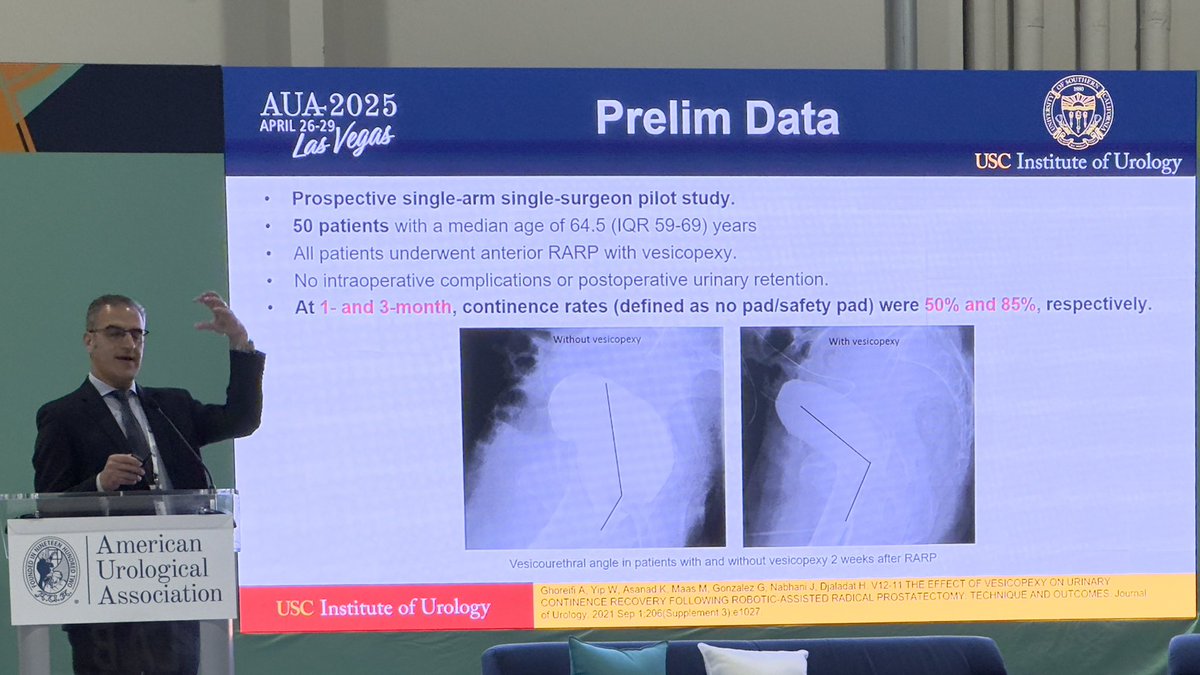 Hooman Ebrahimi (@hoomanebrahimii) on Twitter photo Compelling presentation by <a href="/Hoomandjaladat/">Dr. Hooman Djaladat</a> #AUA2025 on the ongoing phase 3 trial assessing effect of vesicopexy on urinary continence and quality of life after robotic radical prostatectomy.
📊Preliminary data is out! Findings are promising.
<a href="/FarshadSheybaee/">Farshad Sheybaee Moghaddam</a>
<a href="/alirezaghoreifi/">Alireza Ghoreifi, MD</a> Compelling presentation by <a href="/Hoomandjaladat/">Dr. Hooman Djaladat</a> #AUA2025 on the ongoing phase 3 trial assessing effect of vesicopexy on urinary continence and quality of life after robotic radical prostatectomy.
📊Preliminary data is out! Findings are promising.
<a href="/FarshadSheybaee/">Farshad Sheybaee Moghaddam</a>
<a href="/alirezaghoreifi/">Alireza Ghoreifi, MD</a>