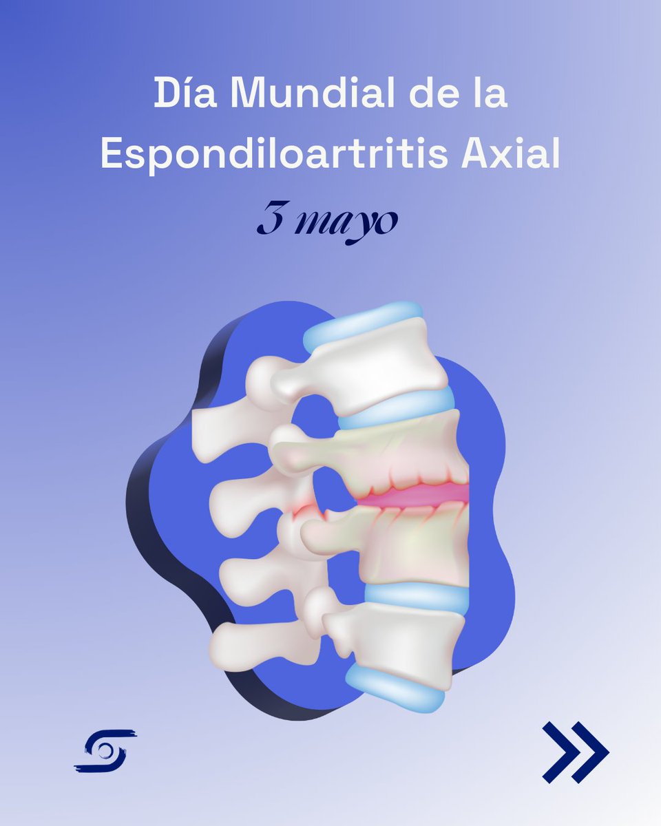 SEReumatologia's tweet image. 💡 ¿Sabías que la #espondiloartritisaxial afecta a aproximadamente 96.000 personas en #España? 

🗓️ En el #DíaMundialdelaEspondiloartritisAxial, recordamos la importancia de conocer los síntomas para acudir al especialista y lograr un diagnóstico precoz.

@CEADE_  #WorldASDay