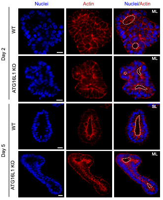 🚨 New paper out! We reveal that noncanonical autophagy (CASM) is a critical driver of epithelial lumen formation. CASM regulates endocytic recycling and mb remodeling—without it, cells can’t resolve into a single lumen.
biorxiv.org/content/10.110…
#Autophagy  #Organoids #Remodeling