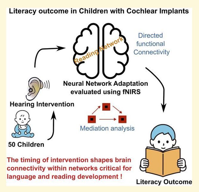 🦻This new #fNIRS research found that how early you hear matters. 

📖Kids w/ #CochlearImplants showed better reading skills with earlier access to sound, thanks to stronger brain connectivity in reading circuits. 

🔗 doi.org/10.1093/brainc…