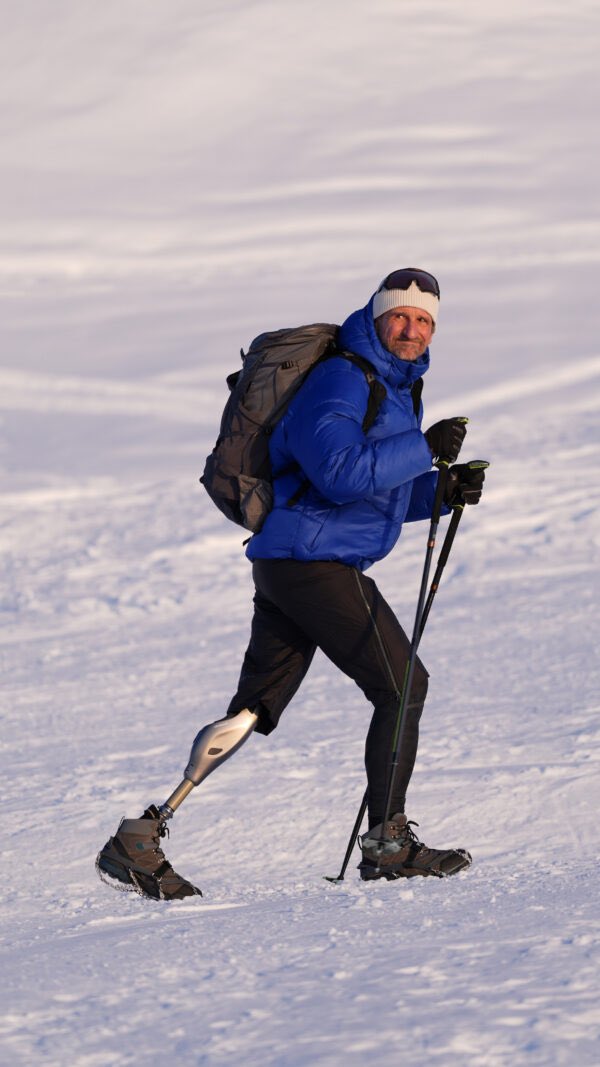 Lidi, asi budu potřebovat ještě trošku pomoct.
Během mé poslední sbírky sem začal trénovat s klasickou protézou a bohužel se potvrdilo, že v mým případě to moc nefunguje. Zbytek nohy je moc krátkej. Pokud sem se chtěl ještě vrátit do služby, musím být přínos, ne přítěž. Tak sem