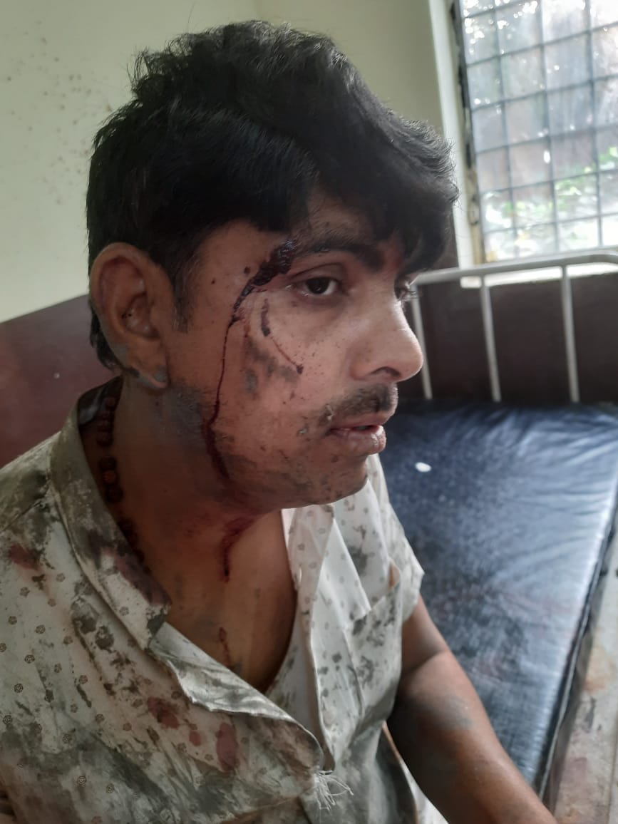 Raghven93521751's tweet photo. पूर्व सैनिक अवध राज सिंह वा उनकी वयोवृद्ध माता जी को घर में घुस कर अपराधियों द्वारा जान से मारने का प्रयास किया गया दोषियों की गिरफ्तारी बाराबंकी पुलिस सुनिश्चित करे । @Barabankipolice @BarabankiD @igrangeayodhya @AkashKhatikMLA @GuptaKankshi @avanindra43 @Pramods19828821 https://t.co/PFL7cWxDNc
