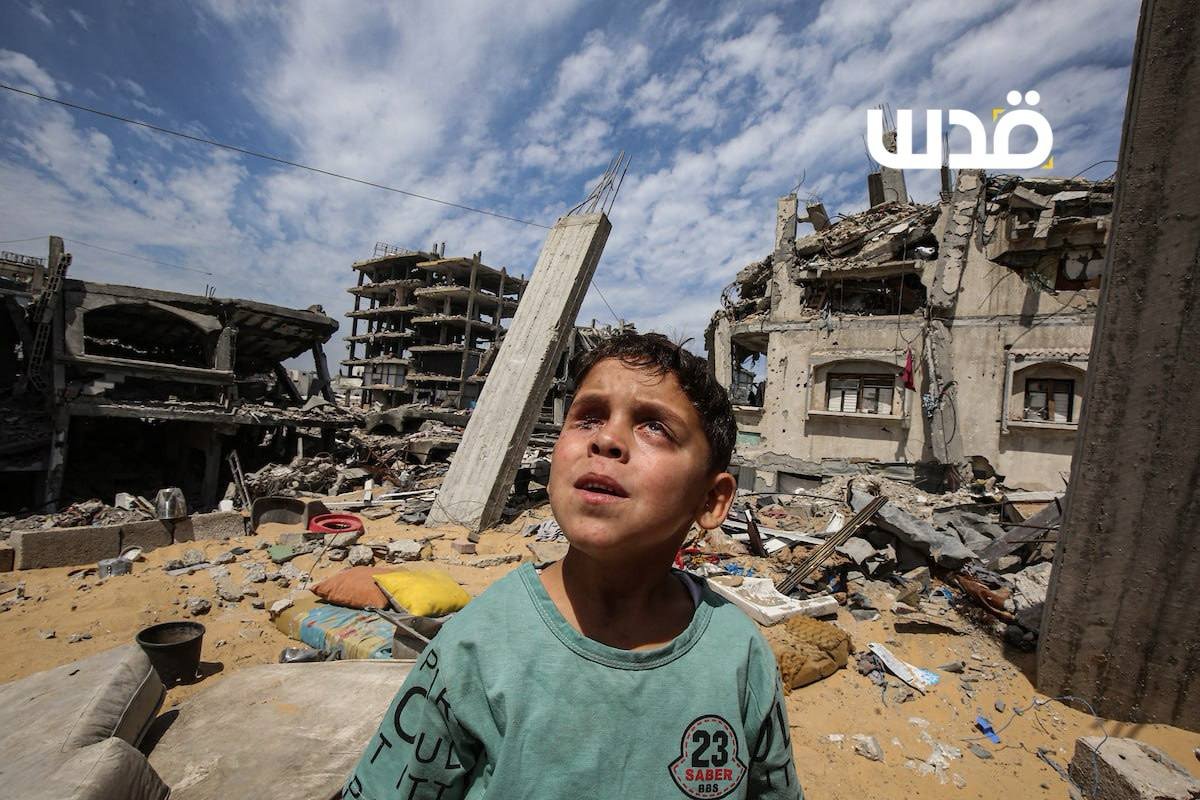 الطفل الفلسطيني محمد حجازي (7 أعوام) يتلقى الرعاية من والده، بعد أن فقد بصره بالكامل نتيجة انفجار جسم مشبوه من مخلفات الاحتلال الإسرائيلي في مخيم جباليا، شمال قطاع غزة.