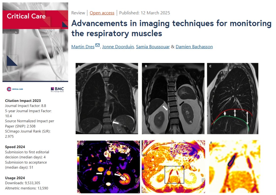 Critical Care (@crit_care) on Twitter photo #CritCare #OpenAccess                       
Advancements in imaging techniques for monitoring the respiratory muscles 
Read the full article: doi.org/10.1186/s13054…
<a href="/jlvincen/">Jean-Louis Vincent</a> <a href="/ISICEM/">ISICEM</a> #FOAMed #FOAMcc #CritCare #OpenAccess                       
Advancements in imaging techniques for monitoring the respiratory muscles 
Read the full article: doi.org/10.1186/s13054…
<a href="/jlvincen/">Jean-Louis Vincent</a> <a href="/ISICEM/">ISICEM</a> #FOAMed #FOAMcc