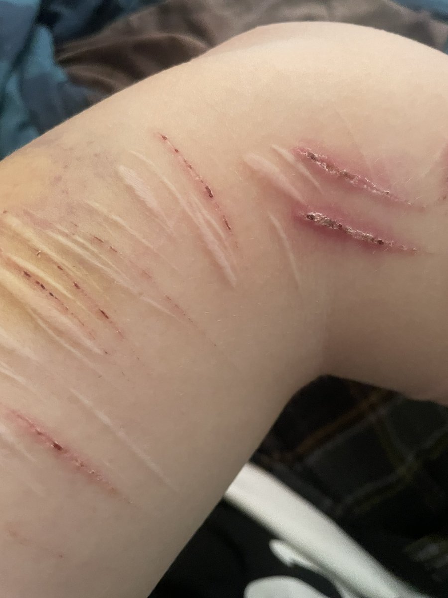 Layne (Addict arc again FUCK) tweet media