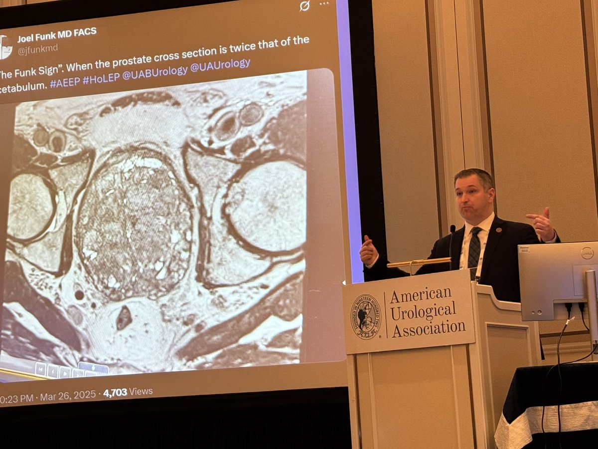 Ricardo R Gonzalez MD (@rrgonzalezmd) on Twitter photo <a href="/DrDeanElterman/">Dean Elterman</a> <a href="/SocietyofBPD/">BPDSociety</a> <a href="/AmerUrological/">Amer. Urol. Assn.</a> <a href="/MaleHealthDoc/">Dr. Steven Kaplan</a> <a href="/UroLori/">LoriLernerUro</a> <a href="/amy_krambeck/">Amy Krambeck</a> <a href="/Dr_KevinZorn/">Dr_KevinZorn</a> <a href="/doreenchungMD/">Doreen E. Chung</a> <a href="/ChughtaiMD/">Bilal Chughtai</a> <a href="/DrLewisKriteman/">Lewis S. Kriteman, M.D., F.A.C.S.</a> <a href="/SmitaDeMD/">Smita De</a> <a href="/squarrier/">Scott Quarrier MD MPH</a> <a href="/BradGillMD/">Brad Gill</a> <a href="/JerryBlaivasMD/">Jerry Blaivas, MD</a> <a href="/jfunkmd/">Joel Funk MD FACS</a>
“The Funk sign” tweet made it into the “MEGA” prostate talk by <a href="/squarrier/">Scott Quarrier MD MPH</a> 🤣
<a href="/jfunkmd/">Joel Funk MD FACS</a> be proud! #BPH #IYKYK <a href="/DrDeanElterman/">Dean Elterman</a> <a href="/SocietyofBPD/">BPDSociety</a> <a href="/AmerUrological/">Amer. Urol. Assn.</a> <a href="/MaleHealthDoc/">Dr. Steven Kaplan</a> <a href="/UroLori/">LoriLernerUro</a> <a href="/amy_krambeck/">Amy Krambeck</a> <a href="/Dr_KevinZorn/">Dr_KevinZorn</a> <a href="/doreenchungMD/">Doreen E. Chung</a> <a href="/ChughtaiMD/">Bilal Chughtai</a> <a href="/DrLewisKriteman/">Lewis S. Kriteman, M.D., F.A.C.S.</a> <a href="/SmitaDeMD/">Smita De</a> <a href="/squarrier/">Scott Quarrier MD MPH</a> <a href="/BradGillMD/">Brad Gill</a> <a href="/JerryBlaivasMD/">Jerry Blaivas, MD</a> <a href="/jfunkmd/">Joel Funk MD FACS</a>
“The Funk sign” tweet made it into the “MEGA” prostate talk by <a href="/squarrier/">Scott Quarrier MD MPH</a> 🤣
<a href="/jfunkmd/">Joel Funk MD FACS</a> be proud! #BPH #IYKYK