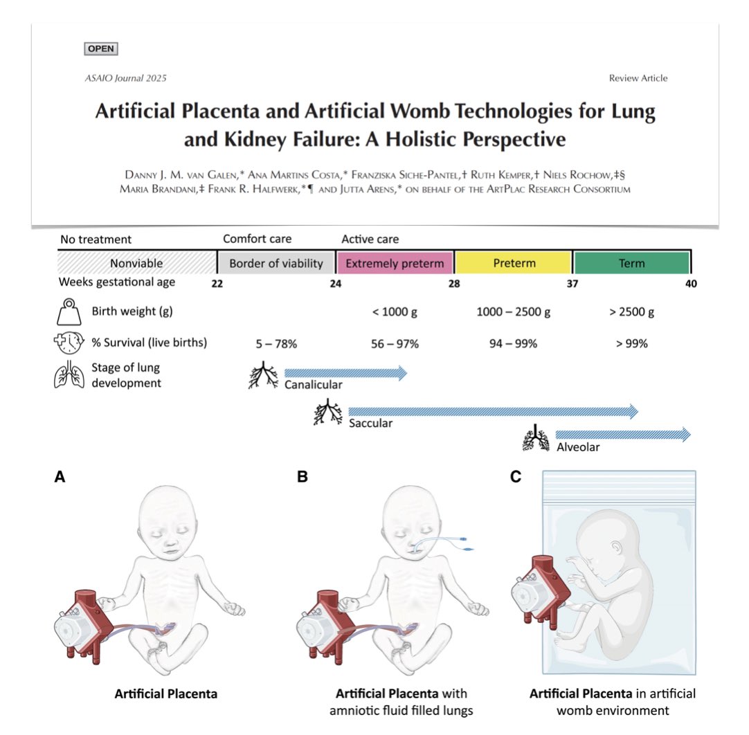 M Velia Antonini (@foamecmo) on Twitter photo Artificial placenta & artificial womb: state-of-the-art review
🔬most AP/AW studies focus on tech feasibility based on in-vivo animal tests: although development still faces serious challenges, human trials are on the horizon
#PedsICU <a href="/asaiojournal/">asaiojournal</a>
🔓 bit.ly/4lQVYIu Artificial placenta & artificial womb: state-of-the-art review
🔬most AP/AW studies focus on tech feasibility based on in-vivo animal tests: although development still faces serious challenges, human trials are on the horizon
#PedsICU <a href="/asaiojournal/">asaiojournal</a>
🔓 bit.ly/4lQVYIu