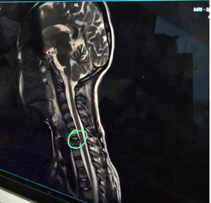 Quick Update... sorry am late again.. family updates 1st..

Naana has been in surgery since 3 PM today.. We chose not to share this earlier because we did not want you all worrying for the past 5+ hrs (3pm OT - 8:30pm DC to ICU)
I spoke to the doctor. الحمد لله everything went as