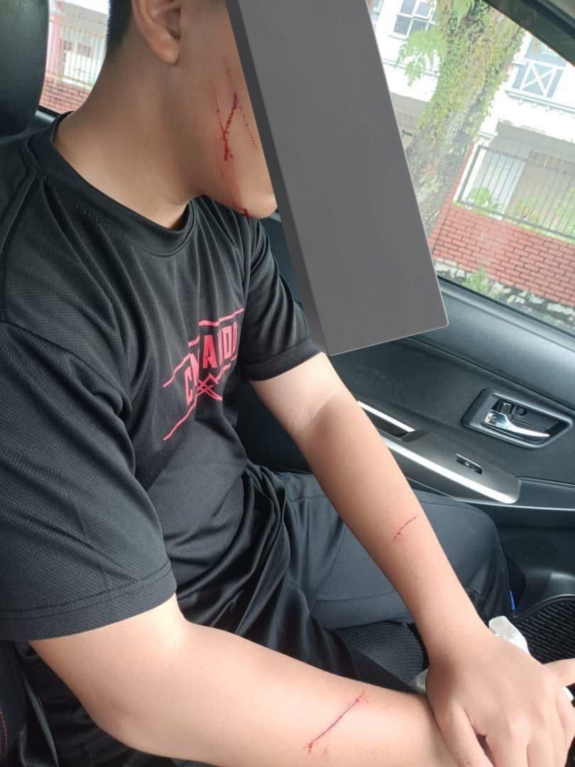 mhmmdhsm's tweet image. Remaja umur 15 tahun hampir di culik semasa berjogging dekat dekat shah alam &amp;amp; bergelut dengan 2 lelaki untuk melepaskan diri. 

Bahaya betul zaman sekarang tolong gais yang lelaki jaga diri tambah2 yang ada anak muda. Ini nasib selamat