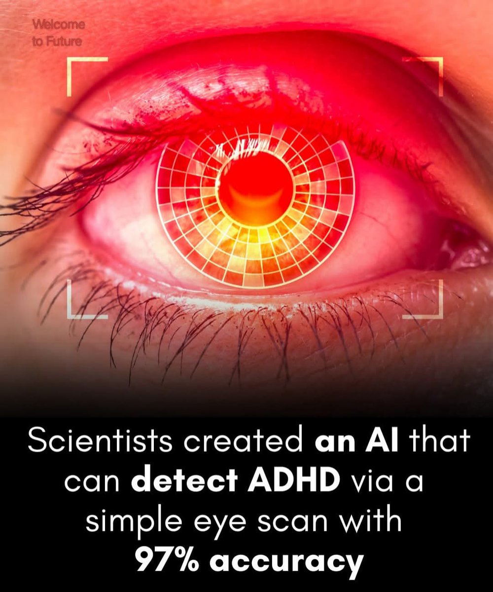 Your eyes reveal more than you think — scientists found a way to predict ADHD with a retinal scan. 

source nature.com/articles/s4174…

#AI #retinalscan