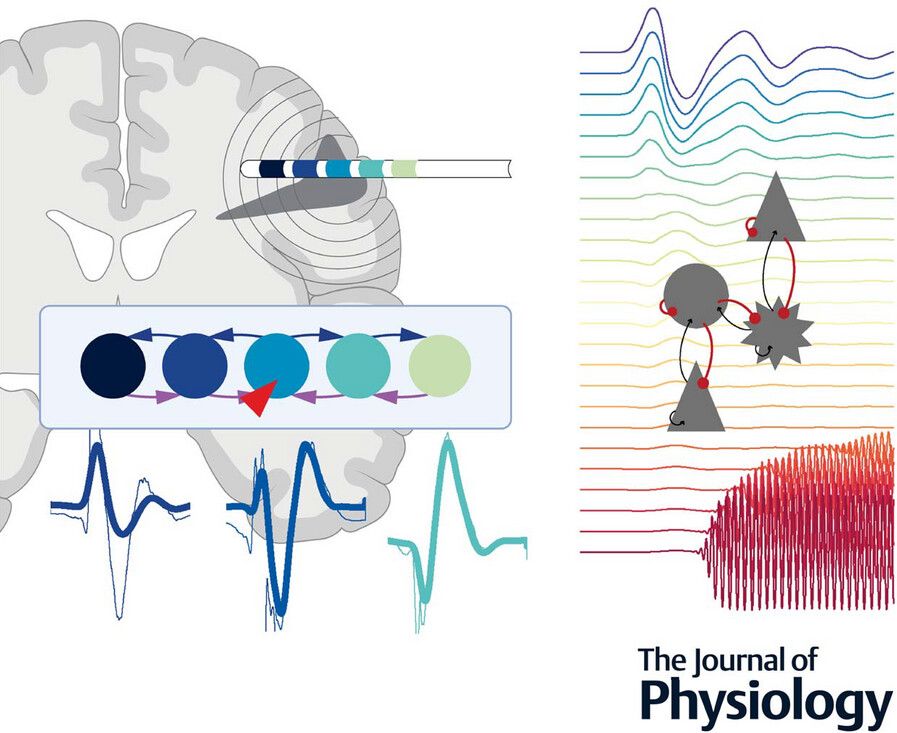 Journal of Physiology (@jphysiol) on Twitter photo Stasa Tumpa (<a href="/ImagingNeuroUCL/">Department of Imaging Neuroscience</a> <a href="/MedCambridge/">Medicine at Cambridge</a>) et al. observed that interictal discharges spread along local recurrent #networks between tubers and surrounding cortex 🔗 🧠
📜 Read the #Research here: buff.ly/53KrpUJ Stasa Tumpa (<a href="/ImagingNeuroUCL/">Department of Imaging Neuroscience</a> <a href="/MedCambridge/">Medicine at Cambridge</a>) et al. observed that interictal discharges spread along local recurrent #networks between tubers and surrounding cortex 🔗 🧠
📜 Read the #Research here: buff.ly/53KrpUJ