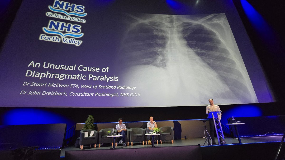 juniorBSTI's tweet photo. 🩻  BSTI ASM 2025 Day 2

🫁 Now onto some excellent cases by our radiology resident doctors bringing the wonderfully rare thoracic paraganglioma &amp; rarer still pulmonary light chain deposition disease!

📣 Dr. Katherine Lee
Dr. Stuart McEwan
Dr. Emma Roditi https://t.co/TYSDDpuuJT