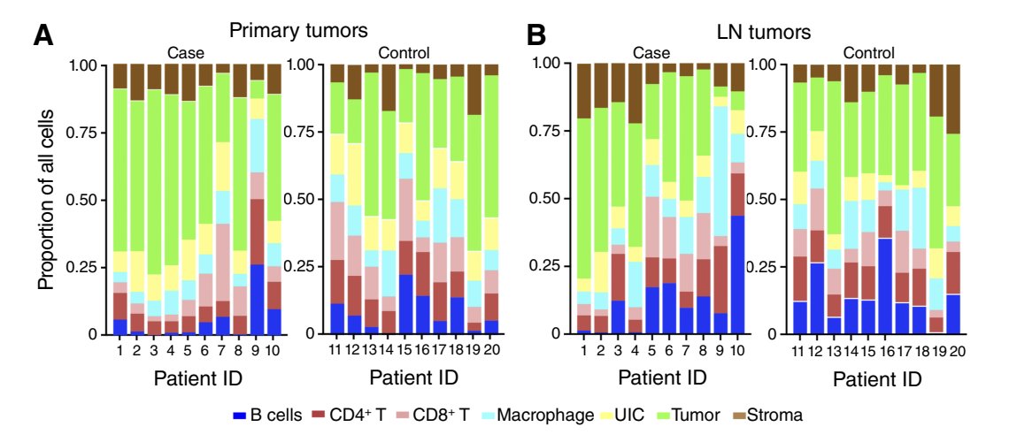 Mayo Clinic ENT (@mayoclinicent) on Twitter photo How do the composition and interactions of immune cells in primary HPV(+)OPSCC tumors influence time to event and clinical outcomes?
Click to read more: bit.ly/44NBES6
#MayoClinicENTResearch #MedTwitter <a href="/KathyBartemes/">Kathleen Bartemes</a> #RaymondMoore <a href="/BrennaNovotny/">Brenna C. Novotny</a> <a href="/KPavelko/">Kevin Pavelko</a> #WillSherman How do the composition and interactions of immune cells in primary HPV(+)OPSCC tumors influence time to event and clinical outcomes?
Click to read more: bit.ly/44NBES6
#MayoClinicENTResearch #MedTwitter <a href="/KathyBartemes/">Kathleen Bartemes</a> #RaymondMoore <a href="/BrennaNovotny/">Brenna C. Novotny</a> <a href="/KPavelko/">Kevin Pavelko</a> #WillSherman