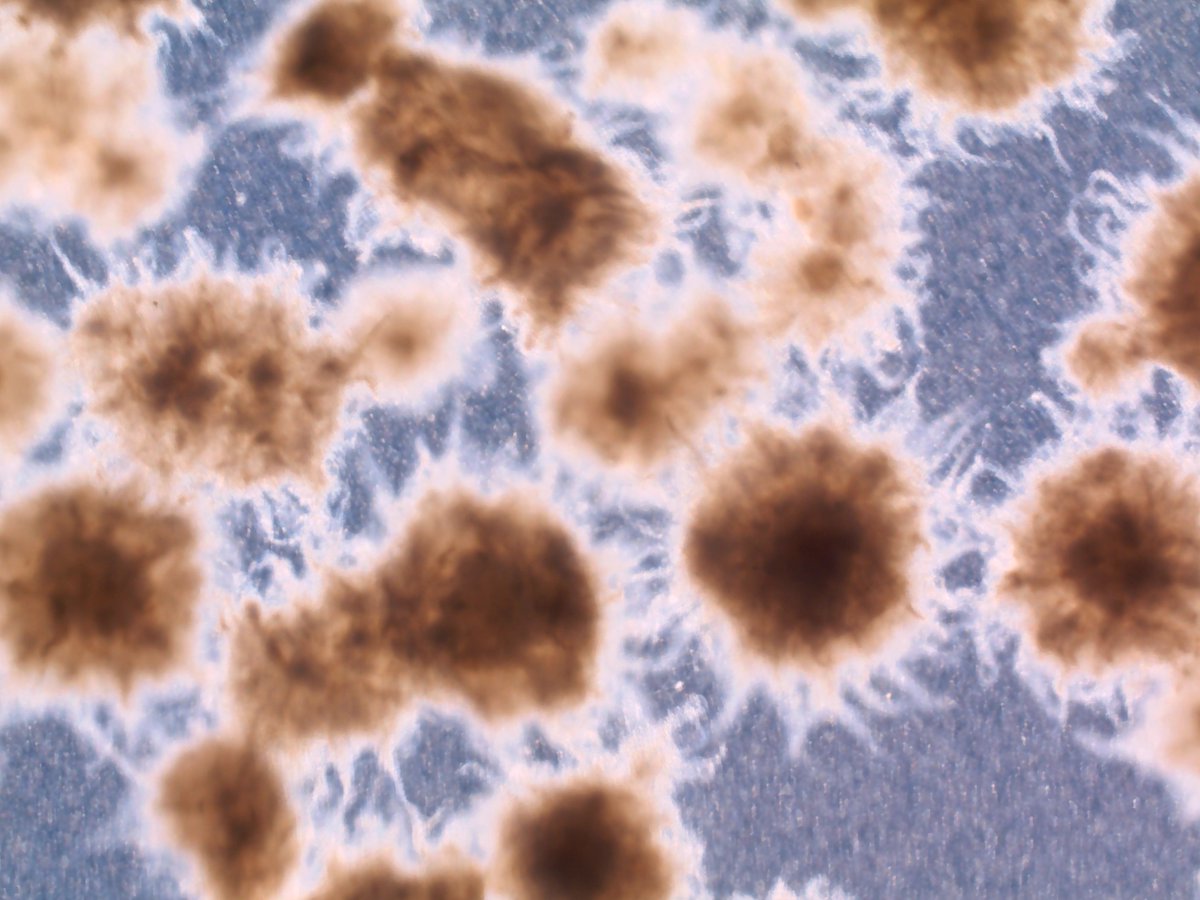 Tiffany Yee (@tiffanyyee12) on Twitter photo No idea what has contaminated my retinal organoids, but <a href="/WertLaboratory/">Wert Laboratory</a> is suspicious I am secretly working for Colossal creating a Woolly retina 😅
Has anyone ever seen this before? No idea what has contaminated my retinal organoids, but <a href="/WertLaboratory/">Wert Laboratory</a> is suspicious I am secretly working for Colossal creating a Woolly retina 😅
Has anyone ever seen this before?