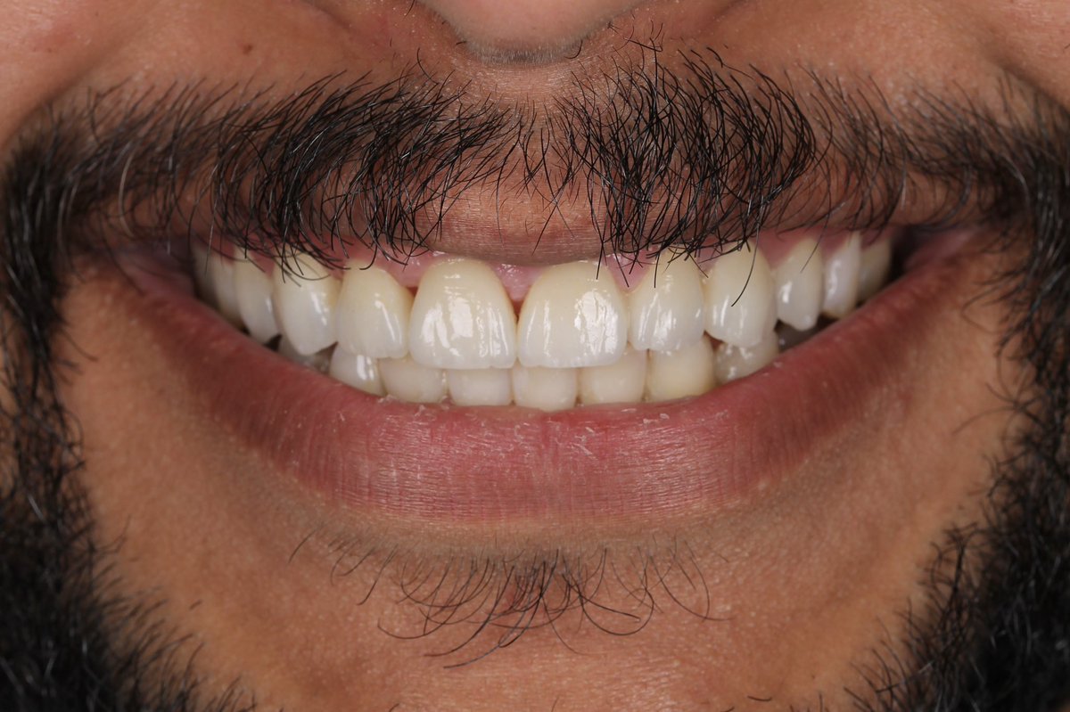 Nawaf Alhumizi. tweet media