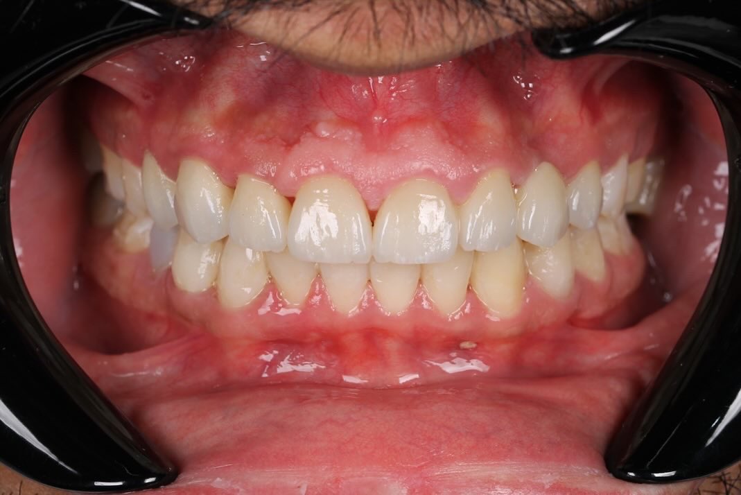 Nawaf Alhumizi. tweet media