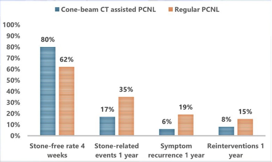 Intraoperative cone beam computed tomography for detecting residual fragments during percutaneous nephrolithotomy: one-year follow-up results from a randomized controlled trial. Presentation by Reimer Adam Kingma, MD. #AUA25 written coverage by <a href="/mariahch00/">Mariah</a> <a href="/UCI_Urology/">UCI Urology</a> &gt;