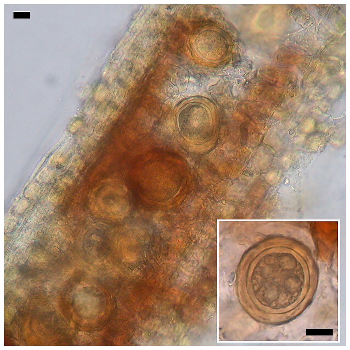 Tyler B. Bourret et al. identified #Phytophthora cyperi as the cause of disease in yellow nutsedge in Idaho and Oregon onion fields. Learn more: doi.org/10.1094/PHYTOF…