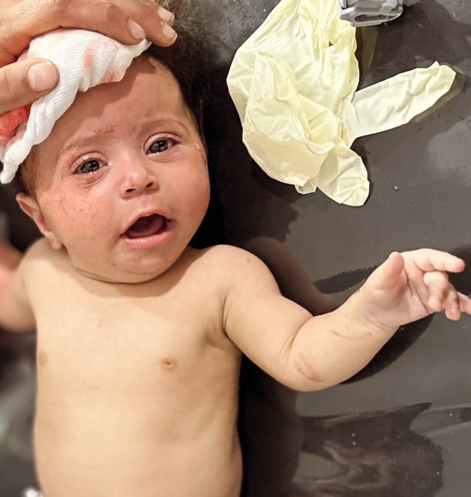 Gazze'de bütün gece enkaz altında kalan bebek oğlan güvenli bir şekilde kurtuldu. Kimsenin paylaştığını görmüyorum. Ölmüş olsaydı, herkes paylaşırdı! Pozitifliği paylaşın...