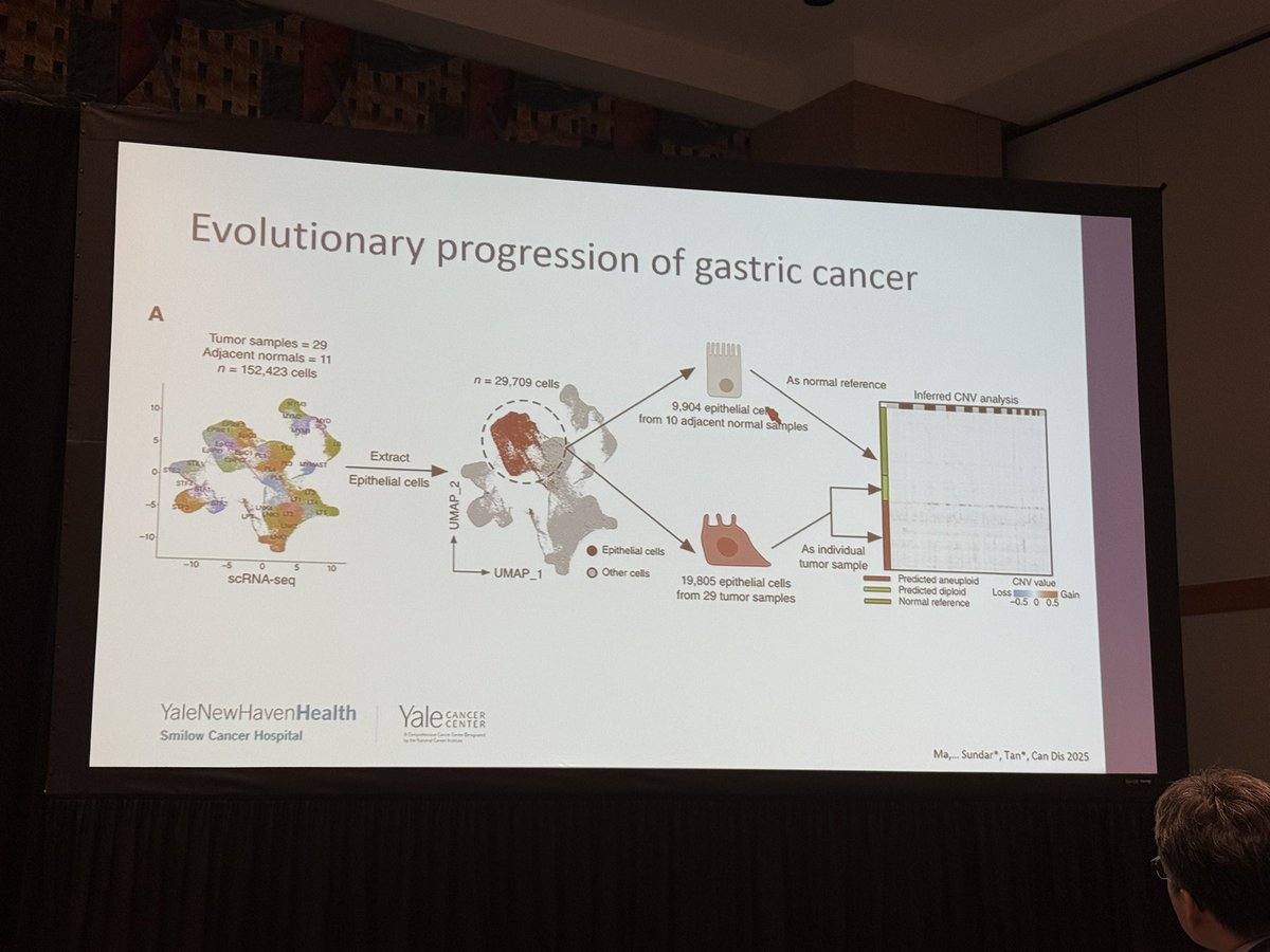 Yale Cancer Center (@yalecancer) on Twitter photo .<a href="/sundar__raghav/">Raghav Sundar</a> shares how spatial heterogeneity is driven to an evolution over space and time in #gastriccancer. As the tumor morphs, so does the TME, warranting different considerations in treatment based on heterogeneity differences. #AACR25 <a href="/YaleGICancers/">Center for Gastrointestinal Cancers</a> <a href="/SmilowCancer/">Smilow Cancer Hospital</a> .<a href="/sundar__raghav/">Raghav Sundar</a> shares how spatial heterogeneity is driven to an evolution over space and time in #gastriccancer. As the tumor morphs, so does the TME, warranting different considerations in treatment based on heterogeneity differences. #AACR25 <a href="/YaleGICancers/">Center for Gastrointestinal Cancers</a> <a href="/SmilowCancer/">Smilow Cancer Hospital</a>