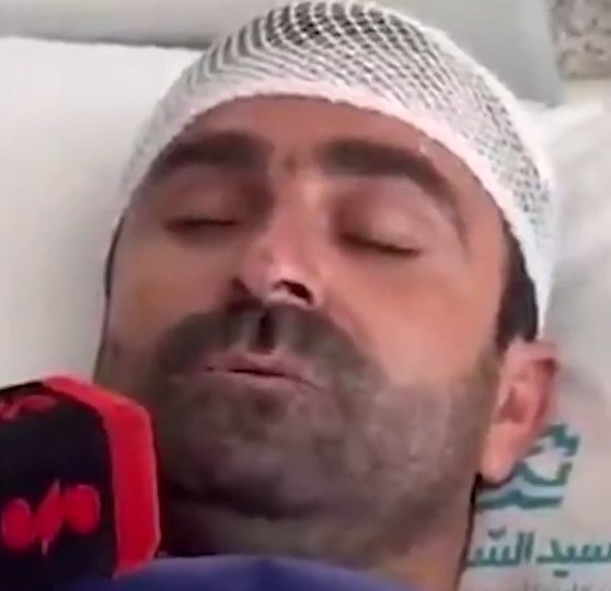 <a href="/cicikhanoom/">سی سی خانوم</a> مصدوم مربوطه نیم‌ساعت قبل از مصاحبه ریش‌هاش رو آنکادر کرده و صورت رو هم بند انداخته و ابروها رو هم مرتب کرده.
موج انفجار و حرارتی که تا چندصد متر همه‌چیز رو جزغاله و پودر کرده، حتی موهای این مصدوم رو هم نتونسته کز بده.
با اینکه سرش ضربه خورده و چشمهاشو نمیتونه باز نگهداره، اما