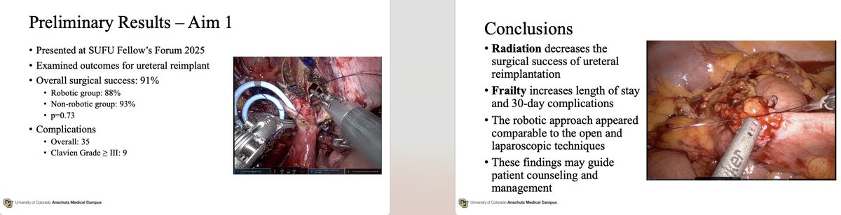 Brian J. Flynn, M.D. (@brian_j_flynn) on Twitter photo Congratulations!! to 1st year <a href="/IFRUEUrol/">IFRUE-Integrating Functional Recon Urol & Endourol</a> <a href="/SocietyGURS/">GURS</a> Fellow <a href="/kdoersch689/">Karen</a> for being the 18th recipient of the prestigious <a href="/SWIUorg/">SWIU</a> - Elisabeth Pickett Research Award of $10k to <a href="/CU_Urology/">CU Urology</a> for #FRU ureteral research <a href="/CU_Urology/">CU Urology</a> - <a href="/URMCUrology/">URMC Department of Urology</a> collaborative ureteral databank Congratulations!! to 1st year <a href="/IFRUEUrol/">IFRUE-Integrating Functional Recon Urol & Endourol</a> <a href="/SocietyGURS/">GURS</a> Fellow <a href="/kdoersch689/">Karen</a> for being the 18th recipient of the prestigious <a href="/SWIUorg/">SWIU</a> - Elisabeth Pickett Research Award of $10k to <a href="/CU_Urology/">CU Urology</a> for #FRU ureteral research <a href="/CU_Urology/">CU Urology</a> - <a href="/URMCUrology/">URMC Department of Urology</a> collaborative ureteral databank