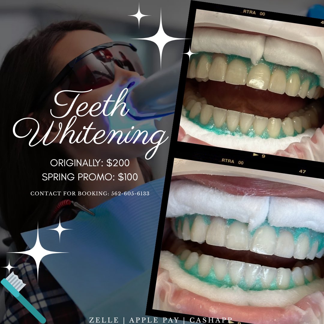 diamondlaneee's tweet photo. Spring promo ‼️ dm to book now https://t.co/U45q20apsn