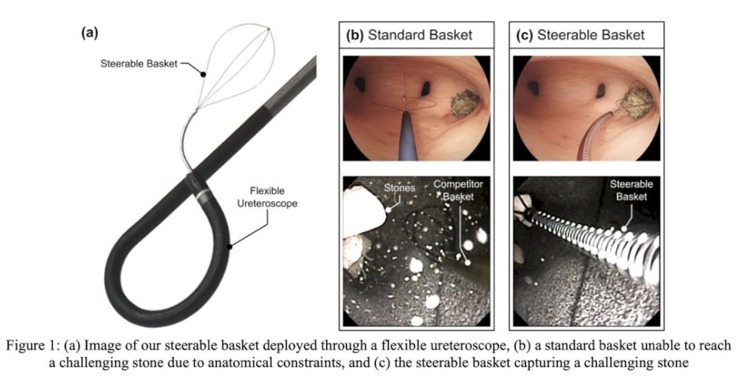 UroToday.com (@urotoday) on Twitter photo Does a steerable #KidneyStone basket provide improved access to difficult-to-reach kidney regions. Presentation by Peter Connor <a href="/VanderbiltU/">Vanderbilt University</a>. #AUA25 written coverage by <a href="/EmanChaudhri/">Eman Chaudhri</a> <a href="/UCI_Urology/">UCI Urology</a> > bit.ly/4cVhJCW Does a steerable #KidneyStone basket provide improved access to difficult-to-reach kidney regions. Presentation by Peter Connor <a href="/VanderbiltU/">Vanderbilt University</a>. #AUA25 written coverage by <a href="/EmanChaudhri/">Eman Chaudhri</a> <a href="/UCI_Urology/">UCI Urology</a> > bit.ly/4cVhJCW