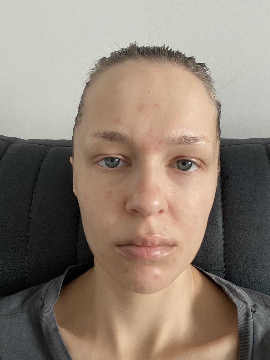 1. Октябрь 2021, ковид позади, авторитаризм медленно перерастает в диктатуру. Страна сжимаемся, будущее туманно 
2. Апрель 2025, Живу в относительно свободной стране, есть даже внж этой страны, будущее по-прежнему туманно

Это мой личный дневник, для этого и пост, мне очень хуево