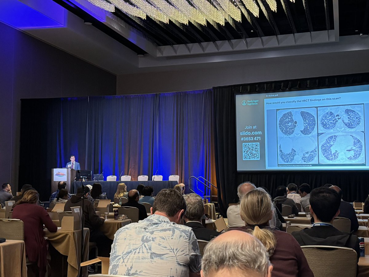 EmergRad's tweet image. Amazing Lecture over lunch dedicated in simplifying “Interstitial lung diseases”.
#arrs2025 #ARRS25 #radres @UTSW_Radiology