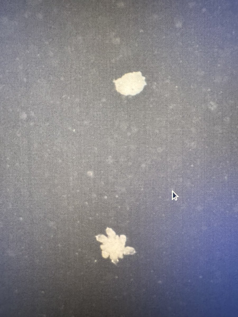 The fact that both of these can be falling in the same volume mere inches apart and look this wildly different means we have a lot to learn about hail. From the supercell-icane storm today in TX near Guthrie.