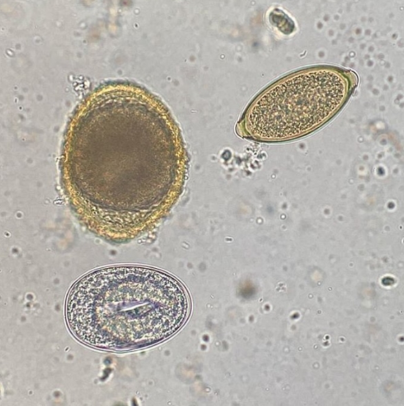 Toxocara canis, Ancylostoma sp. e Trichuris sp. em coproparasitológico de canino.

🔁 REPOST DE: 🩺MV José Augusto Miranda.
IG @lab_clinico_vet