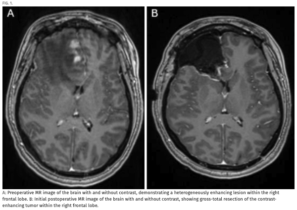 Journal of Neurosurgery tweet media