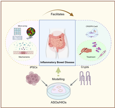 Learn about the utility of stem cell-derived intestinal #organoids in modeling inflammatory bowel disease in this new review. #IBD 👇

bit.ly/3EG2nFI