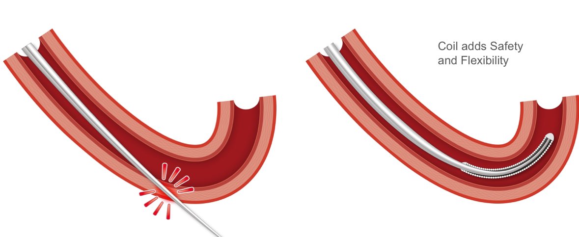 Poonam Velagapudi (@pooh_velagapudi) on Twitter photo Let’s continue learning abt #guidewires! #sponsored <a href="/AIU_Medical/">Asahi Intecc USA, Inc. Medical Sales</a>
What is the role of the ‘coil’?
⭐️makes up the diff in diameter between tapered end & the desired finish diameter
⭐️transmits torque along the tapered portion of core to the tip
⭐️adds flexibility & safety Let’s continue learning abt #guidewires! #sponsored <a href="/AIU_Medical/">Asahi Intecc USA, Inc. Medical Sales</a>
What is the role of the ‘coil’?
⭐️makes up the diff in diameter between tapered end & the desired finish diameter
⭐️transmits torque along the tapered portion of core to the tip
⭐️adds flexibility & safety
