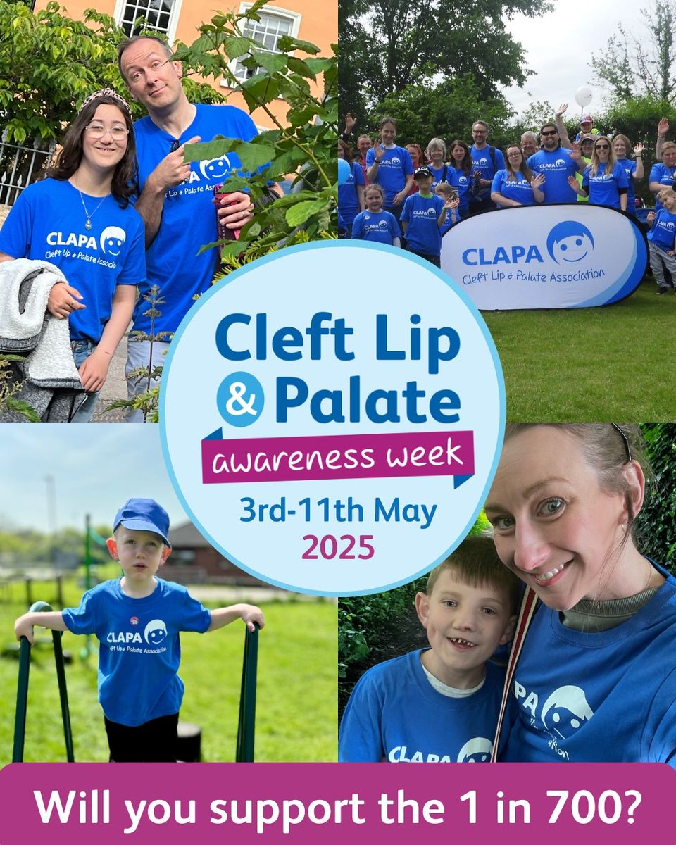 CLAPACOMMUNITY's tweet photo. ⚠️Last Chance: Make a pledge and request your fundraising materials today to arrive in time for Cleft Lip and Palate Awareness Week!

How can you support us?
💙 Organise a 'Wear it Blue' day
🍰 Hold a 'Cuppa for CLAPA'
❔ Organise your own fundraiser! 

🔗 https://t.co/PwsfNS0imk https://t.co/mKQ8UoPQOM