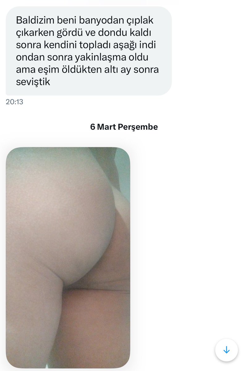 baldınızı paylaşan bir takipçimiz