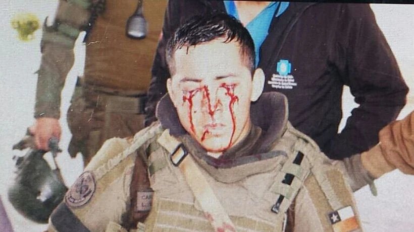 Rafael Torreblanca 🇨🇱 (@gradegeorge) on Twitter photo El funcionario <a href="/Carabdechile/">Carabineros de Chile</a> Luis Lemún Jaque, de 28 años
Apoyo a <a href="/ClaudioCrespoG/">CLAUDIO CRESPO</a> !! El funcionario <a href="/Carabdechile/">Carabineros de Chile</a> Luis Lemún Jaque, de 28 años
Apoyo a <a href="/ClaudioCrespoG/">CLAUDIO CRESPO</a> !!
