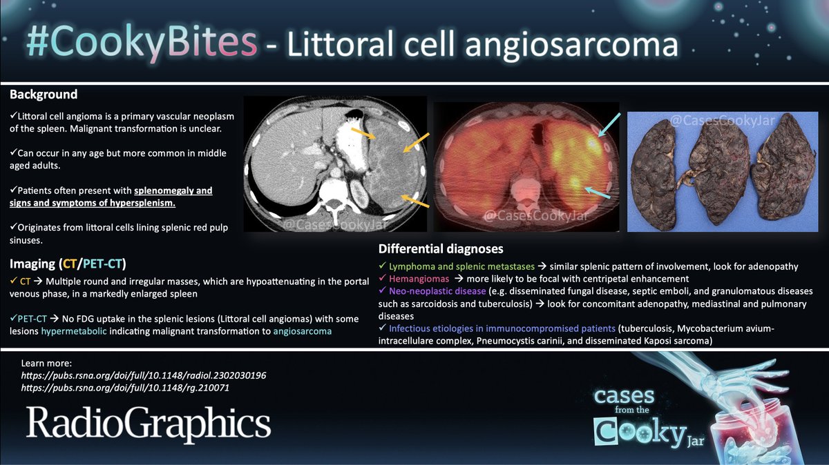 Cases From the Cooky Jar (@casescookyjar) on Twitter photo Answer: Littoral cell angiosarcoma
Learn more:
pubs.rsna.org/doi/full/10.11…
pubs.rsna.org/doi/full/10.11…
#CookyBites #215 #RGphx <a href="/cookyscan1/">Cooky Menias</a> <a href="/RadioGraphics/">RadioGraphics</a> Answer: Littoral cell angiosarcoma
Learn more:
pubs.rsna.org/doi/full/10.11…
pubs.rsna.org/doi/full/10.11…
#CookyBites #215 #RGphx <a href="/cookyscan1/">Cooky Menias</a> <a href="/RadioGraphics/">RadioGraphics</a>