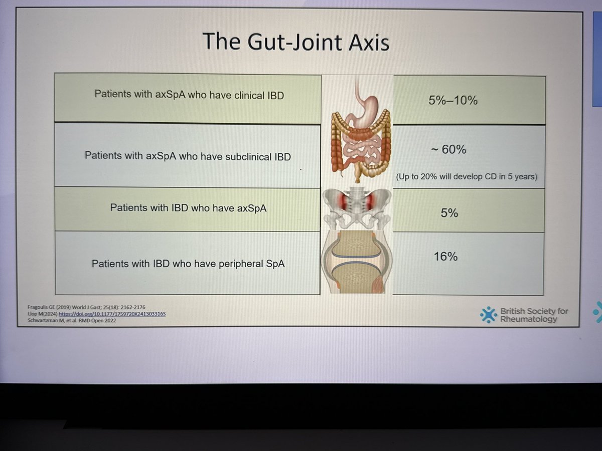 The Gut-Joint Axis
➡️ up to 10% of #axSpA pts have IBD 
➡️ &amp; up to 60%! - have subclinical IBD
1/5 develop Crohns within 5Y
#BSR25 [Dr Arora] #Rheumatology #MedTwitter