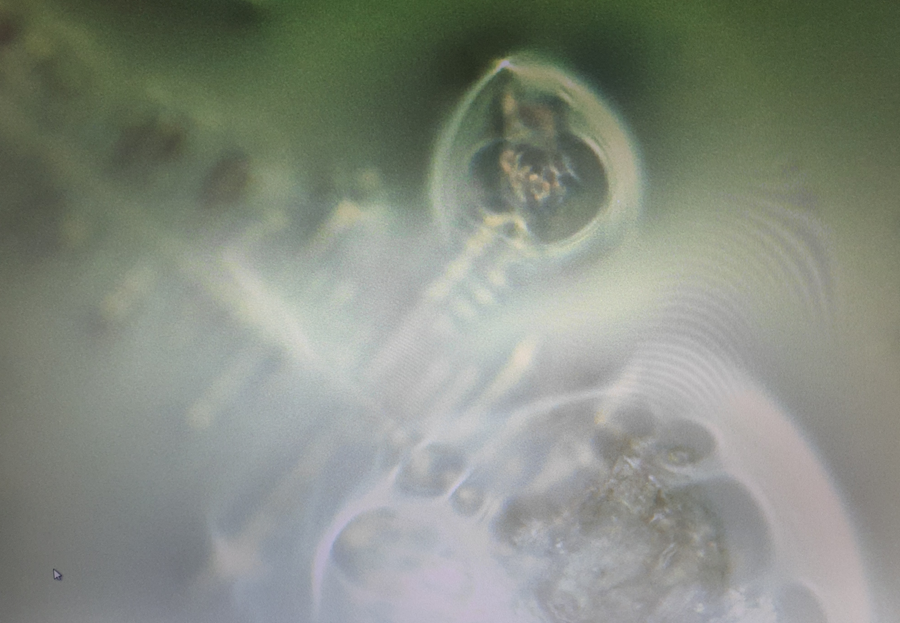 HealthRanger's tweet photo. EXCLUSIVE: After 3 weeks of incubating the @RealDrJaneRuby "chemtrails fallout" / "mystery fog" sample with saline solution at human body temperature, we now have confirmed proof of small CREATURES COMING TO LIFE under the microscope and swimming across the petri dish, all caught on video. I'll be posting the full video Wednesday, mid-day, and you can see it yourself. Here's one of the new images from the video: